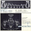 画像6: 【LALIQUE】ルネ・ラリック　TOKYO キャラフ  (6)